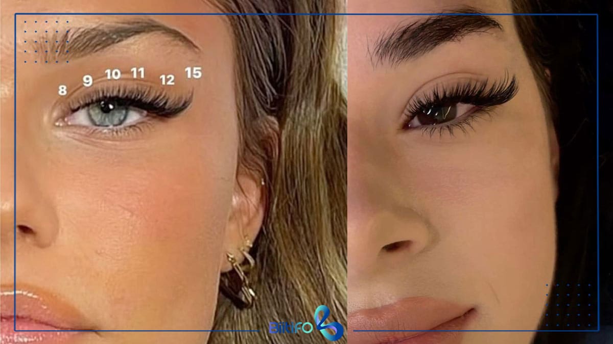 کاشت مژه هیدن گربه‌ای