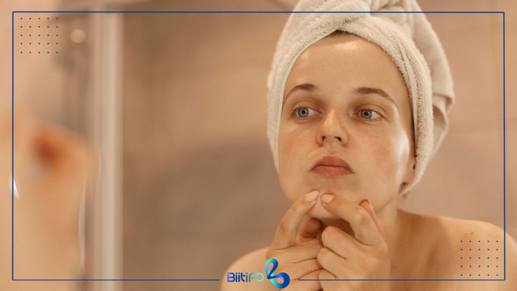 پوست چرب چه نوع پوستی است؟