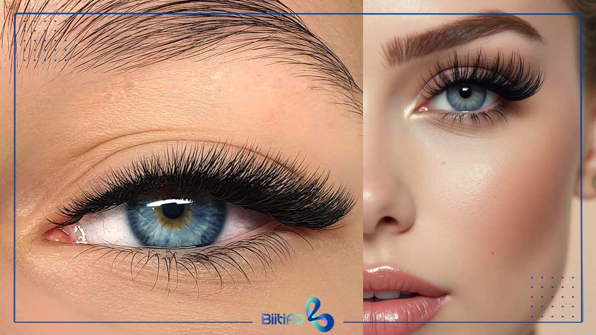 کاشت مژه گربه‌ای والیوم 
