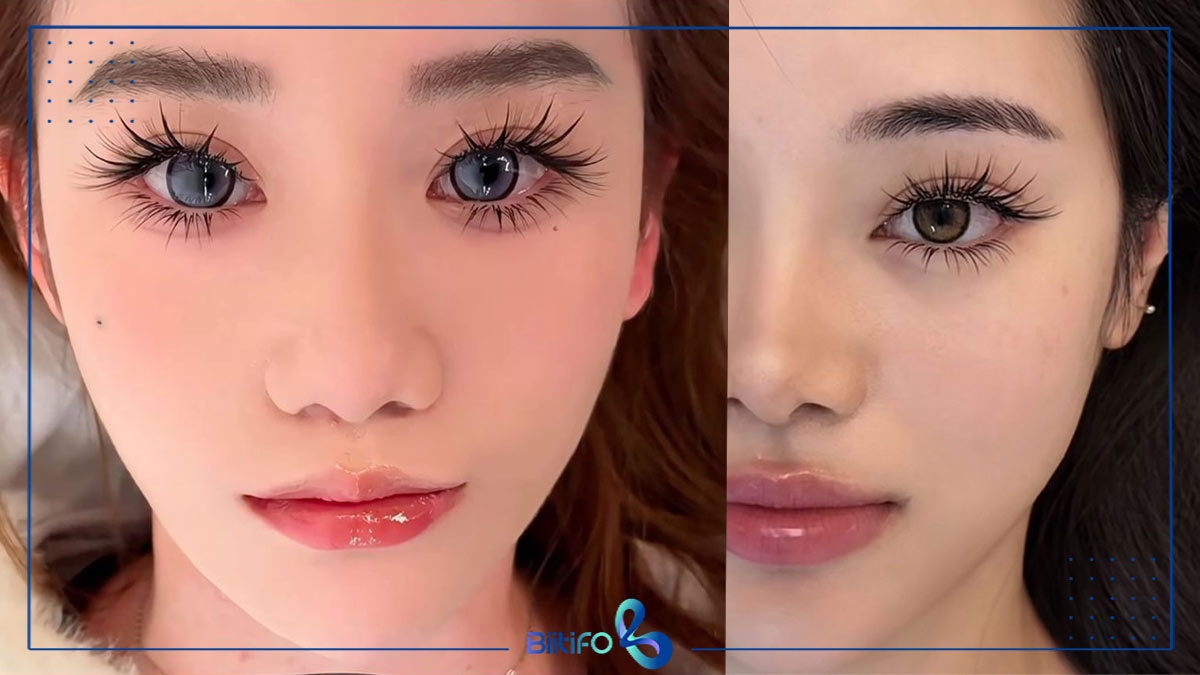 کاشت مژه اسپایکی سنجابی