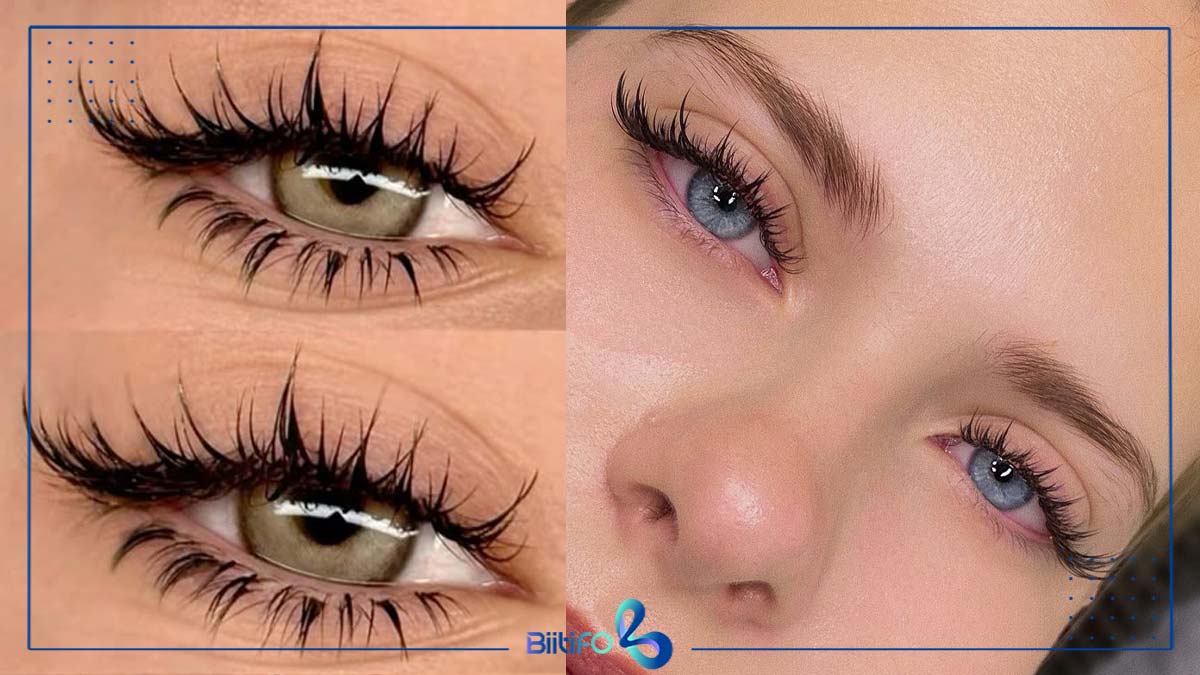 کاشت مژه اسپایکی گربه‌ای