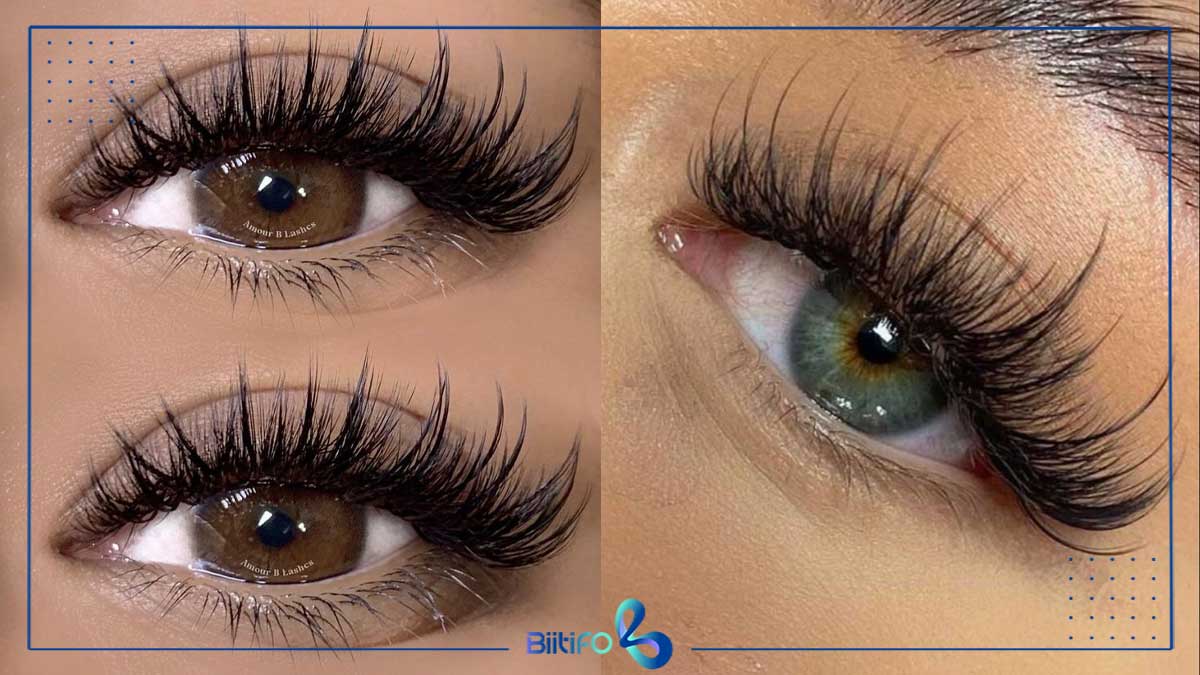 کاشت مژه اسپایکی روباهی