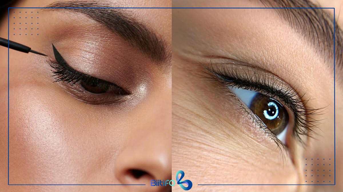 بن مژه چیست؟