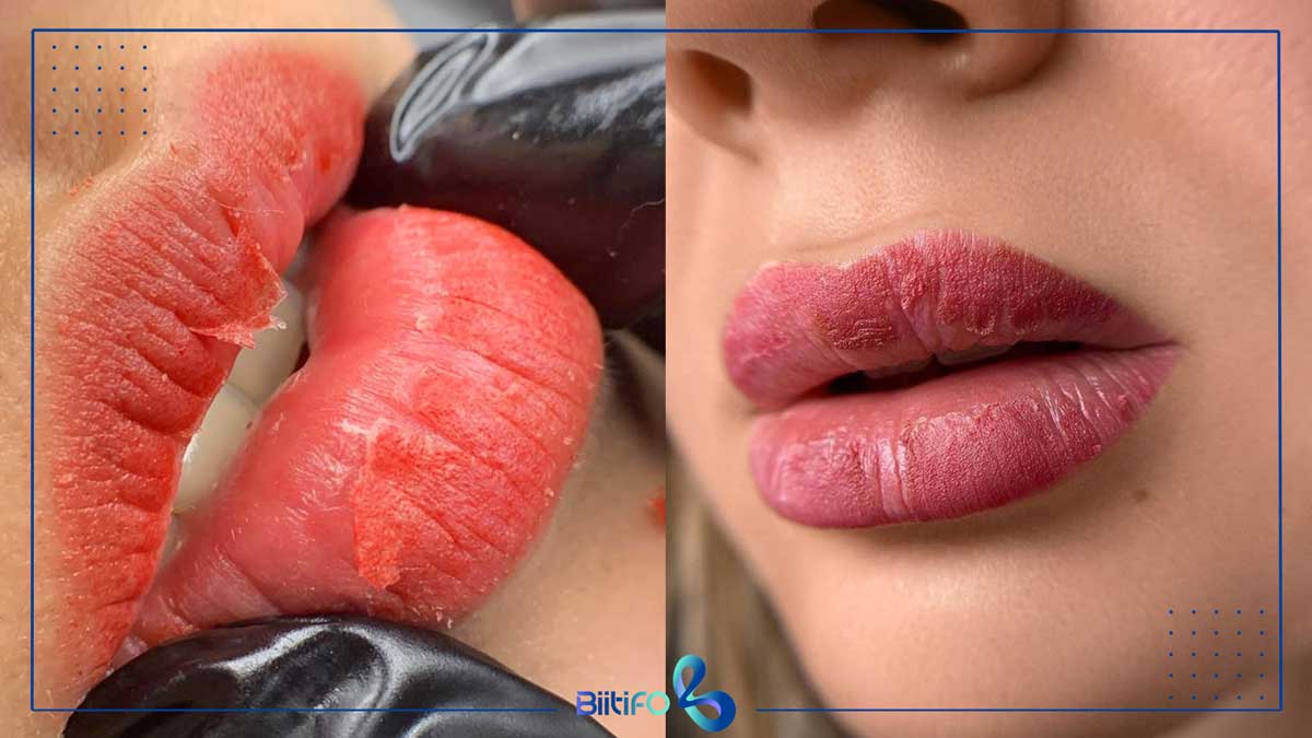 تغییر رنگ اولیه