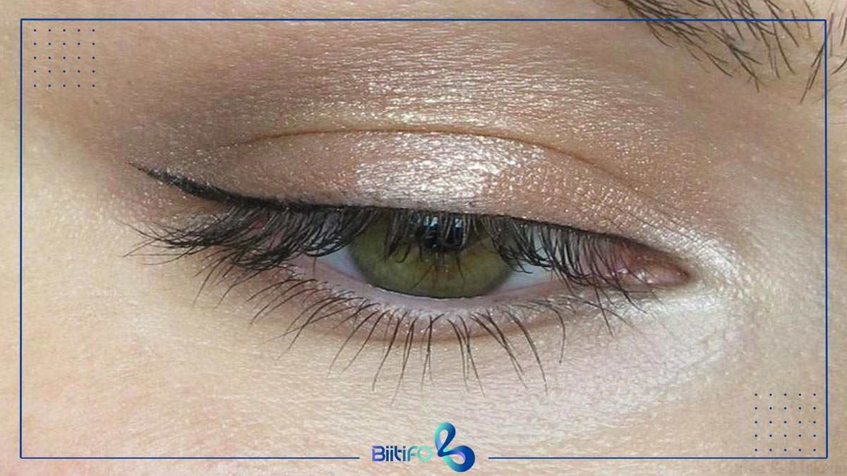 بن مژه حالت‌دار